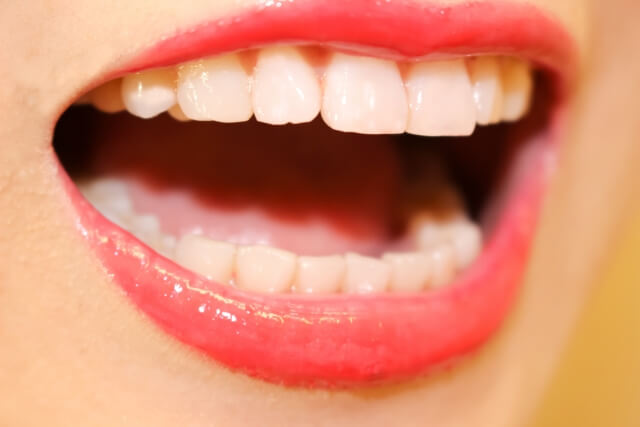 女性が大きく口を開けて覗かせている綺麗な歯並び